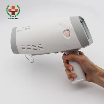 SY-F005 Медицинская Портативная Кольпоскопическая камера Ручной электронный 